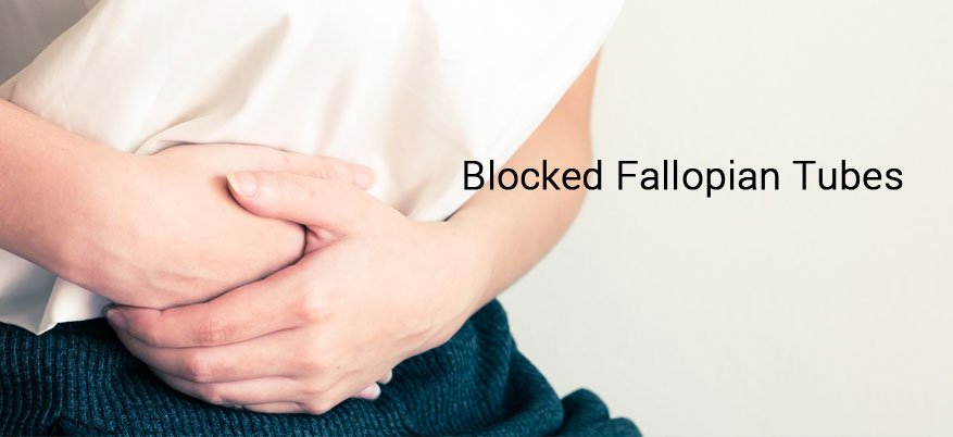Tubal Block and IVF